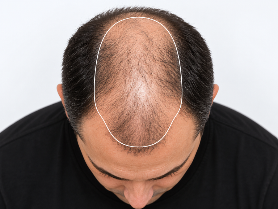 Identifica el área que necesitas cubrir
